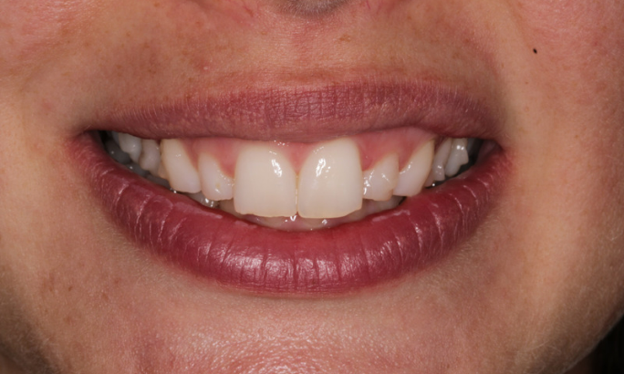Before - Sky Dental 